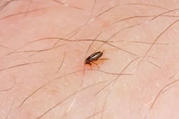 التخلص من البراغيث في المنزل